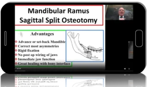Orthognathic and TMJ surgery