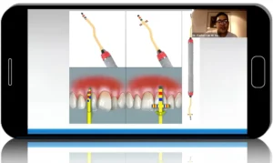 Oral Plastic Surgery for the General Practitioner