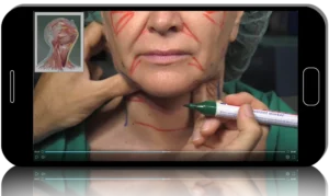 The Art of the Deep Plane: Comprehensive Facial Restoration