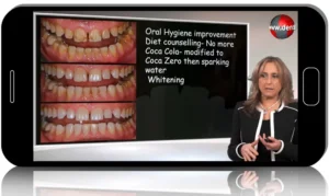 Teeth Whitening and Cosmetic Dentistry