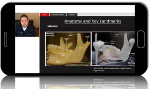 Case Selection for Successful Implant Placement