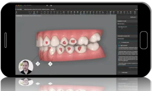 Fundamentals Maximizing Tools and 3D Controls for Invisalign Treatment Planning