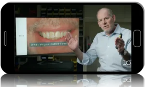 Precision in Dental Restorations: From Veneers to Occlusion - Dental Online Training Mega Course