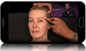 RA Summit Botox and Filler Online Course