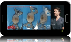 Modern Endodontics Made Simple: From Access to 3D Obturation