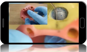 Ninja Sinus Lift