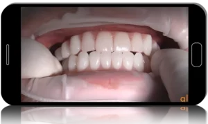 Online Residency Program A-Z in Implant Dentistry