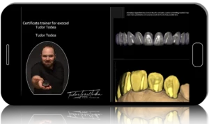 Online School "Exocad from A to Z"