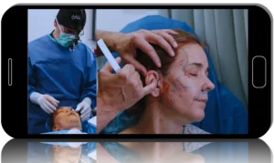 Curso Magistral de Lifting Facial