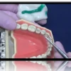 Indirect Bonded Dentistry MasterClass: Veneer, Smil Design, Inlay, Onlay, Overlay, Endo Crown, Table Tops