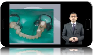 Full Mouth Rehabilitation