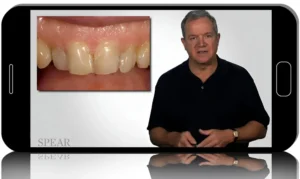 Move Teeth or Restore? Decision-Making for Predictable Alignment