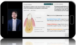 Contemporary Soft Tissue Grafting, Surgery and Science