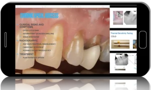 Endodontics MasterClass: Tipton Training