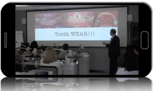 CPR for the Worn Dentition