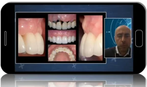 Prosthetic Enhancement of Surgically Augmented Soft Tissue around Dental Implants