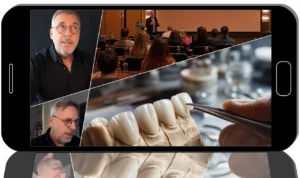 Removable and Fixed Restorations. Unlocking the Secrets of Aesthetics