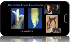 Working Length in Endodontics