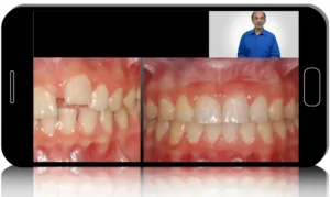 Pediatric Restorative Dentistry Essentials