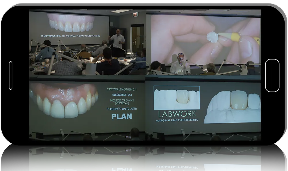 Cosmedent Minimally Invasive Ceramic Restorations: From Concepts to Completion