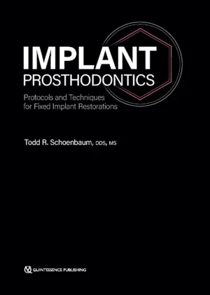 Implant Prosthodontics: Protocols and Techniques for Fixed Implant Restorations