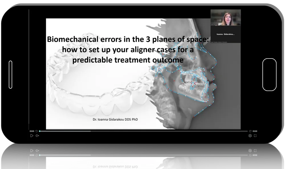 Aligner Mastery: Troubleshooting Complex Clinical Challenges
