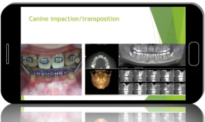 Oakstone Oral and Maxillofacial Surgery Review 2024: A Comprehensive and Contemporary Update