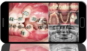 Orthodontic Treatment Mistakes: Camouflage and Retreatment Protocols for Compromised Cases