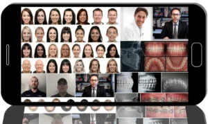 Orthodontic Treatment in Alveolar Bone Bone Deficiencies