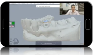 IN-OFFICE ALIGNERS: profitable treatment option for doctors, more effective treatment process for patients