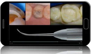 Crafting Dental Restorations That Truly Stand Out