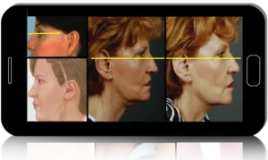 The Surgeon’s Edge: Cutting-Edge Aesthetics and Live Operative Insights, Amsterdam